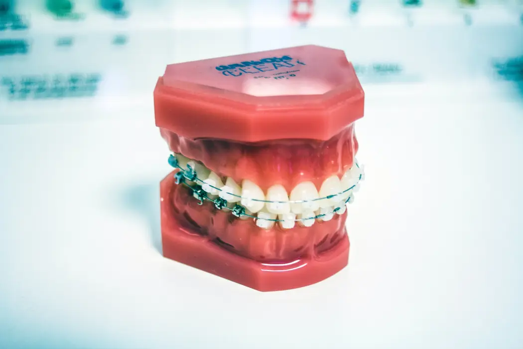 Ortodonta dziecięcy - kiedy warto się do niego udać? Jakie zabiegi wykonuje?