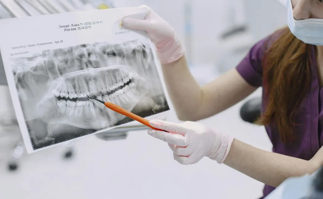 RTG i tomografia 3D zębów bez tajemnic  co pokazują, ile kosztują i czy są bezpieczne?