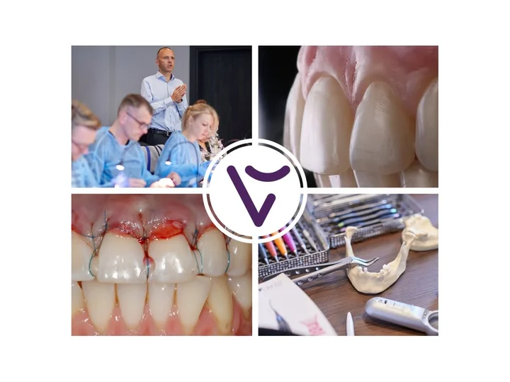 Grafika promocyjna wydarzenia Chirurgia plastyczna tkanek miękkich – pokrywanie recesji zębów