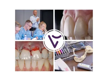 Grafika promocyjna wydarzenia Chirurgia plastyczna tkanek miękkich – pokrywanie recesji zębów